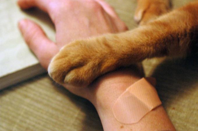 एक बैंडेड मानव हाथ और एक बिल्ली का पंजा।